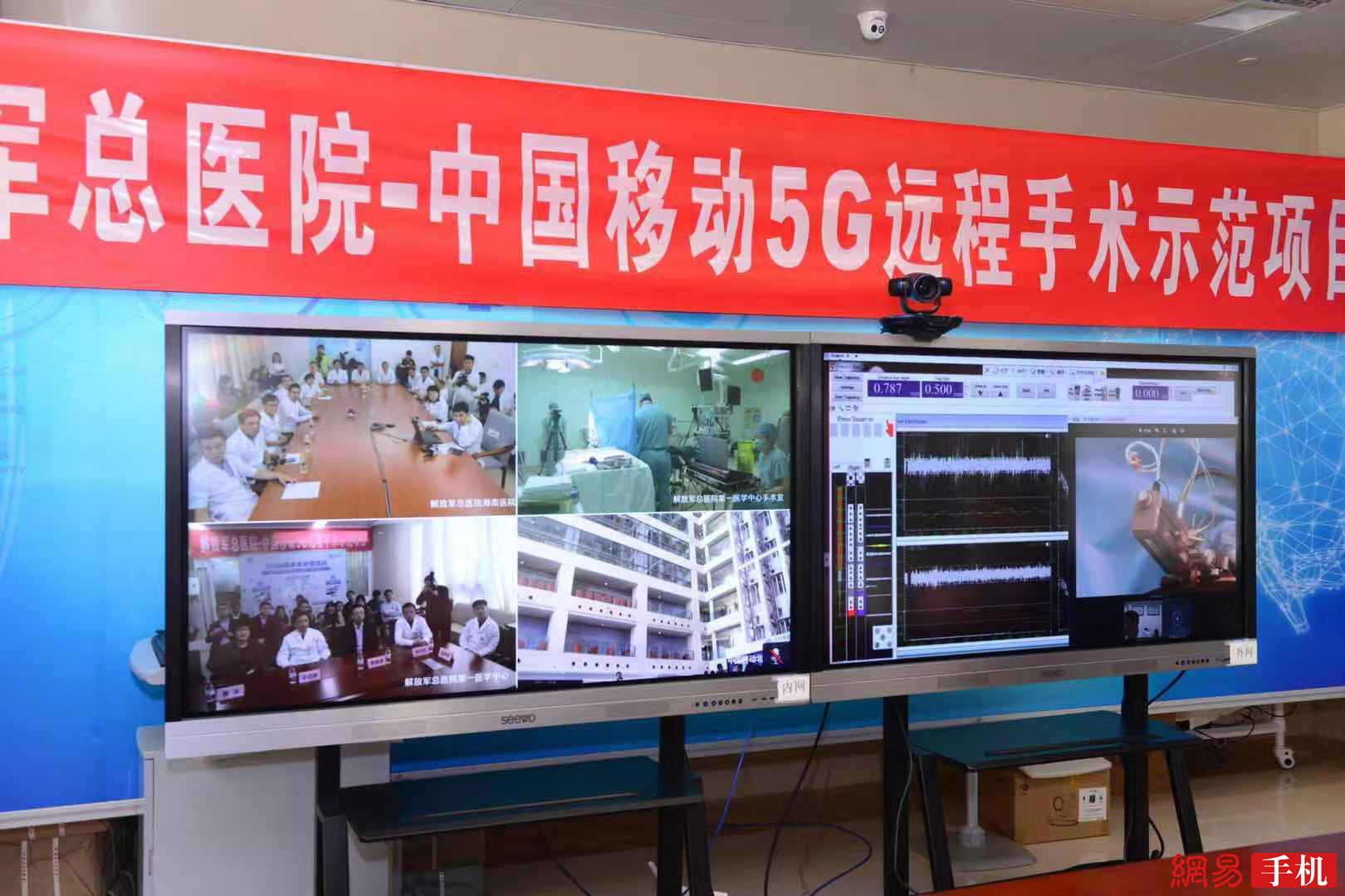 中移动华为助力 全国首例5G远程人体手术成功